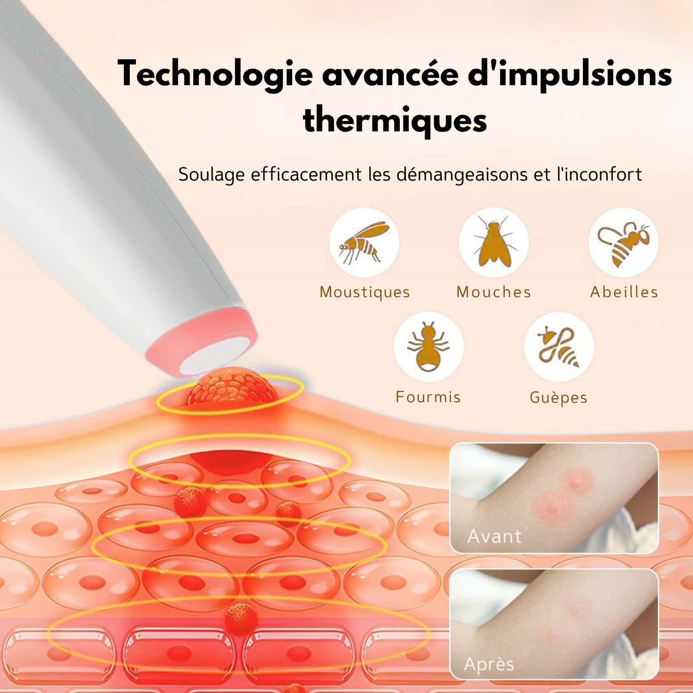 Stylo Anti-Démangeaisons Rechargeable